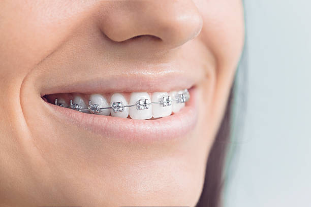 Advanced Technology for Better Dental Care in Bremerton, WA