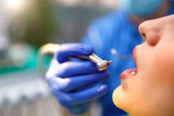 Best Teeth Whitening  in Bremerton, WA